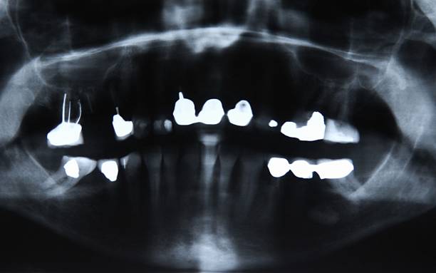 Dentistry X-ray image of female jaw and teeth (Photo by Universal Images Group via Getty Images)