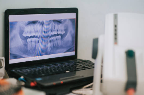 X-ray screen on laptop at dental office